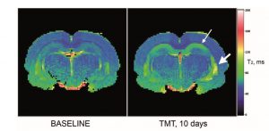 Relaxation Map of Brain