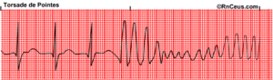 Torsades De Pointes Rnceus