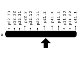 Dmd Gene