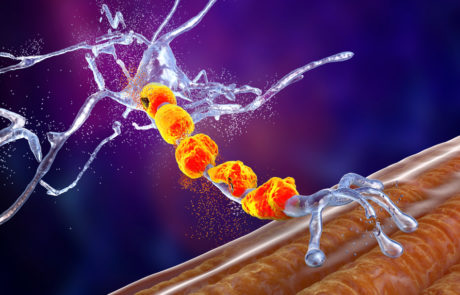 Degrading neuron | ApxoniX