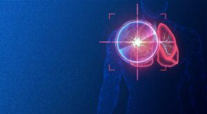 How a target safety assessment supports the drug development process
