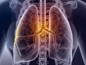 Lungs 1 | Apconix