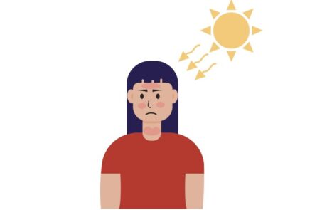 Photosensitivity