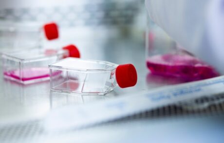 Cell Culture, flasks
