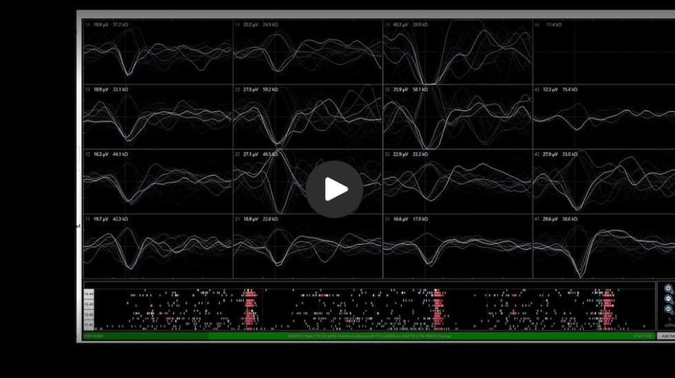 Hipsc Microelectrode Array (Mea) Assay For Sedation 1 Moving Raster Baseline Plot | Apconix