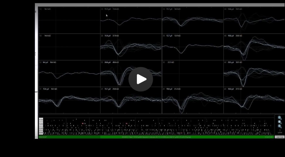 Hipsc Microelectrode Array (Mea) Assay For Sedation 2 Moving Raster Plot With Sedative Compound | Apconix