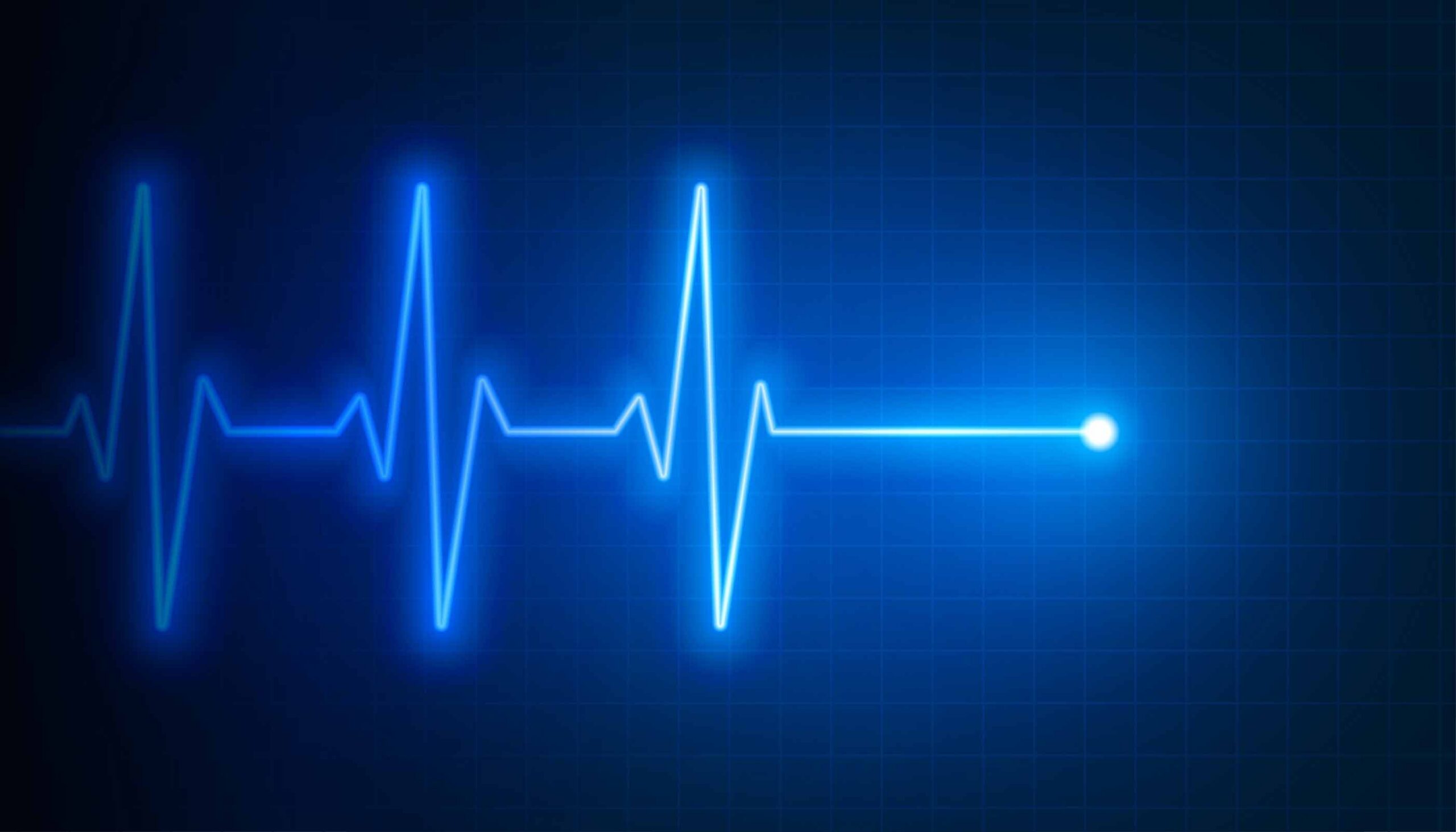 Electrocardiogram Heartbeat Illustration Electrocardiogram Heartbeat Cardiac Safety Scaled | Apconix